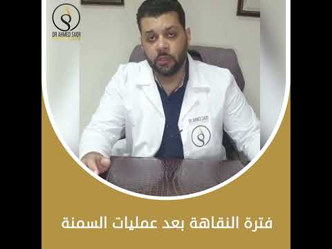 هقعد في البيت أد إيه بعد عملـية السـمنة؟