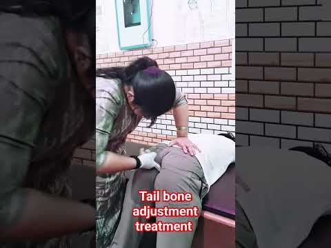 Tail bone adjustment by Dr deepanshi chiropractic, physiotherapist #short #video #viral #tail bone