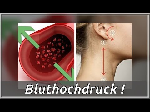 Was ist Bluthochdruck und der Grad Dass die Zahlen des mittleren arteriellen Druck
