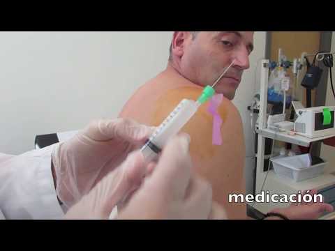 ▸ Tratamiento Hombro Doloroso ¿Cómo es una Infiltración Hombro Doloroso Sindrome Subacromial?