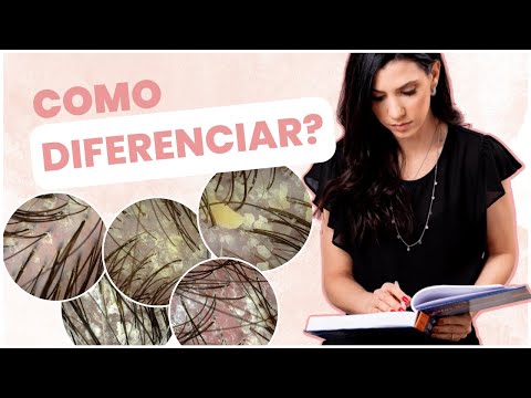 Diferenças entre DERMATITE SEBORREICA e PSORÍASE
