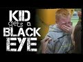 KID GETS A BLACK EYE DaddyOFive Re Upload