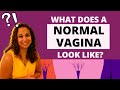 What Does A NORMAL Vagina Look Like Answers Dr Niveditha Manokaran