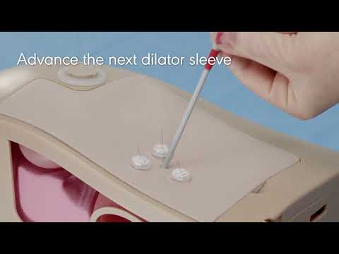 Avanos Enteral Access Dilation System