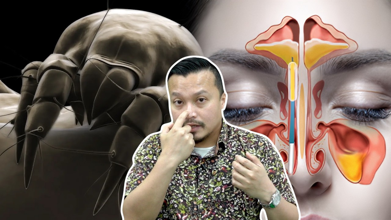 Maksud Sebenar Resdung Menurut Doktor