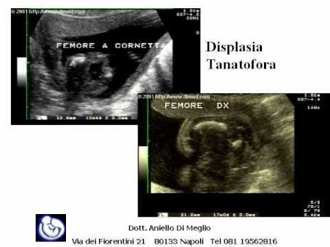 Vista al protesi danca Sostituzione dellarticolazione Chelyabinsk