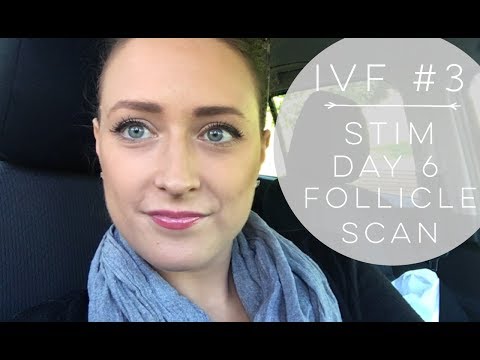 IVF #3 | STIM DAY 6 FOLLICLE SCAN Video