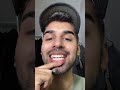 Trying A Crest Whitening Strips For 20 Days Selfcare
