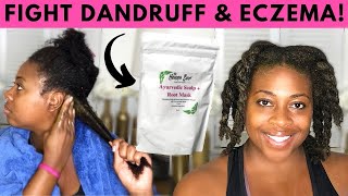 How to Heal Your Scalp Naturally| How to Get Rid of Dry Itchy Scalp Natural Hair