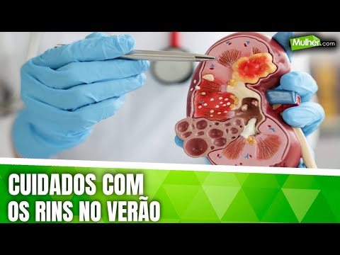 Agnes Neves Santos-8