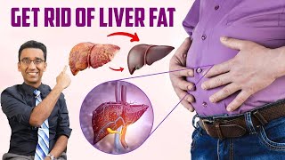 How to DETOX your FATTY liver without medications? | Dr Pal