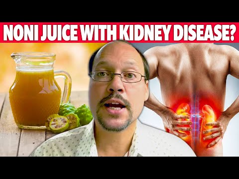 Noni Juice with Kidney Disease. Should You Say Yes or No?