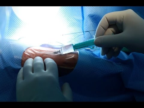 Ritanat Gel Gelenke kaufen Dr. Metzger Nackenschmerzen
