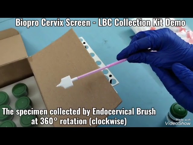 Lbc Testing Cervical cancer - Liquid Based Cytology Manufacturer from Coimbatore