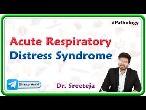 7. Acute Respiratory Distress Syndrome | USMLE Step 1 Pathology