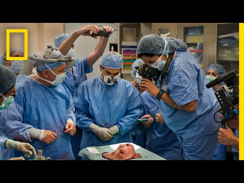 , title : 'Youngest Face Transplant Recipient in U.S. | National Geographic'