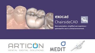 Exocad ChairsideCAD - single crown i500 case