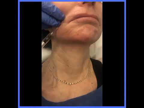 Dr. Rizk Shares the Art of Facial Plastic Surgery