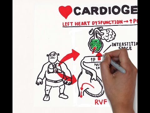 Pulmonary edema (USMLE step 1 )