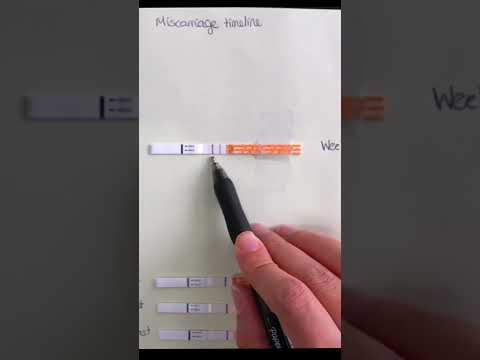 Miscarriage Timeline Breakdown