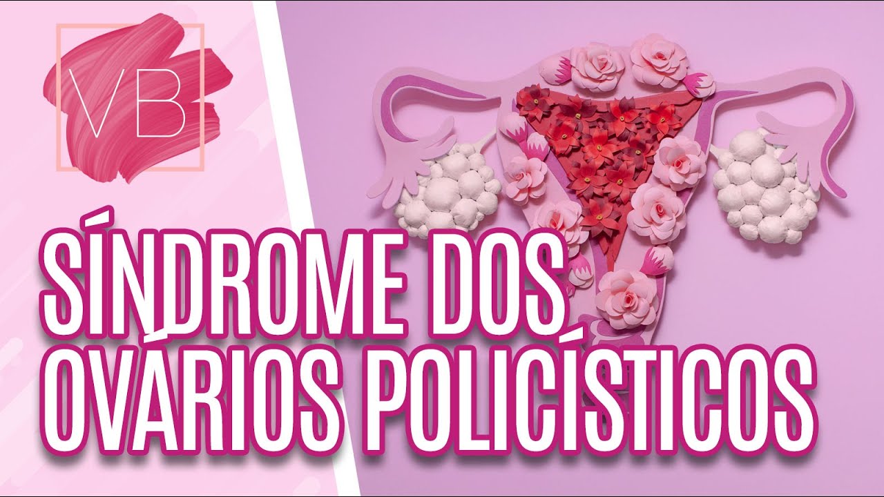 Síndrome dos ovários policísticos: o que é, causas, sintomas e tratamentos- Você Bonita (08/12/2022)