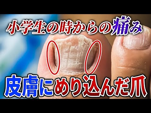 施術動画2