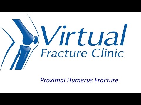 Proximal Humerus Fracture