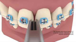 KỀM BẺ KHẤC CHỮ V - V STOP PLIER