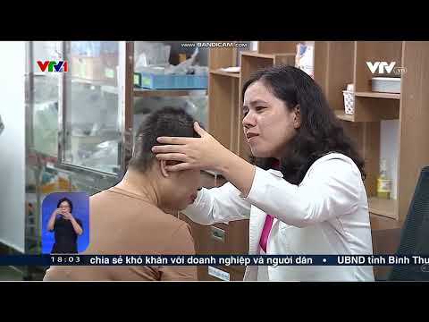 Ghép da đầu thành công cho bệnh nhân bị tai nạn lao động.