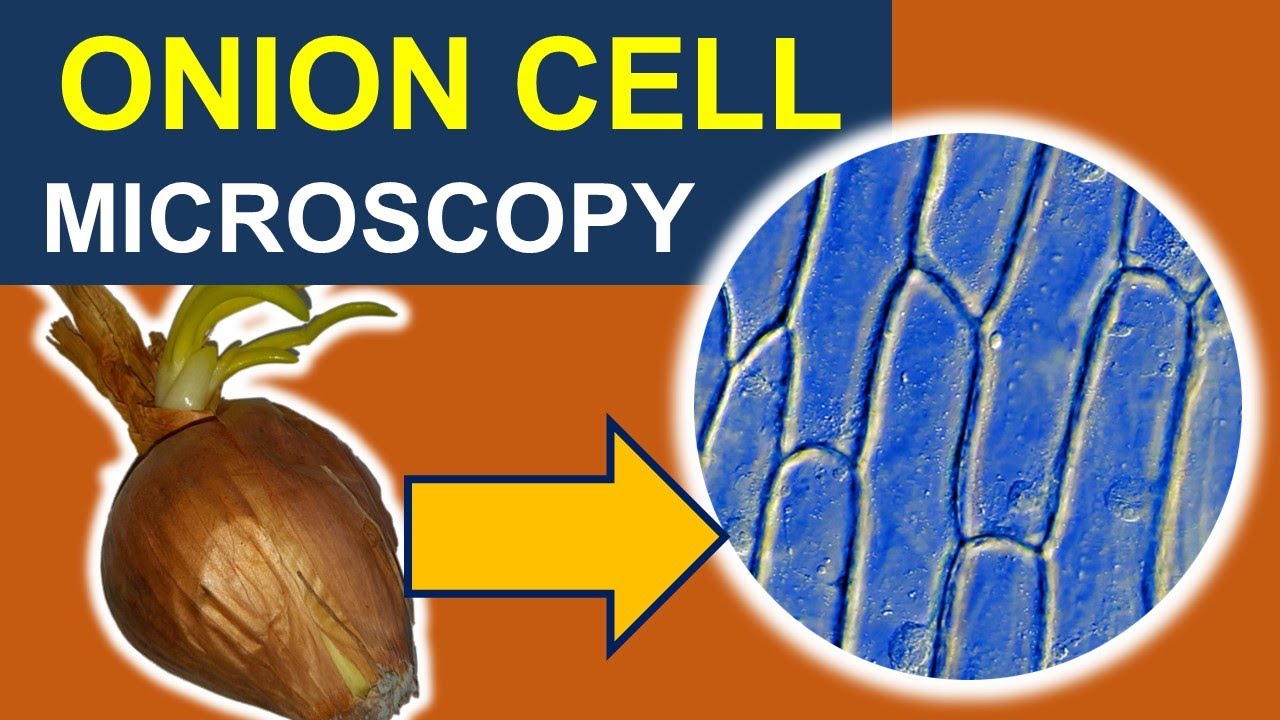 Observing moving CELL ORGANELLES of an ONION under the microscope