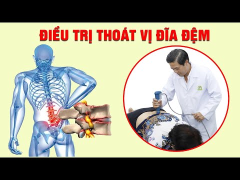 Trị liệu Thoát vị đĩa đệm - Trượt đốt sống - Bằng phương pháp