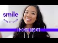 a month wearing smile direct club mouth trays