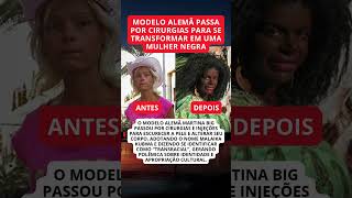 Modelo alemã faz cirurgias para se tornar mulher negra