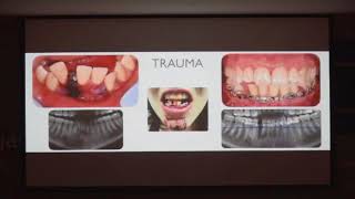 Hi-Clearance 2017 Dental Implant Forum in Taipei - Part 4