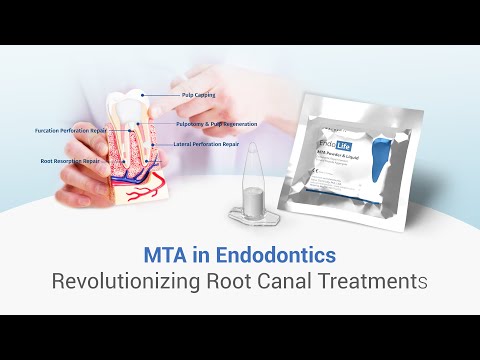 ROLE OF MTA IN ENDODONTICS #dental #dentalkart #waldentMTA #EndolifeMTA