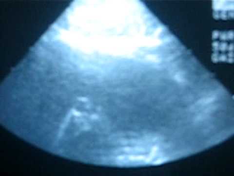 Ashley's baby, just for mike love you!!!