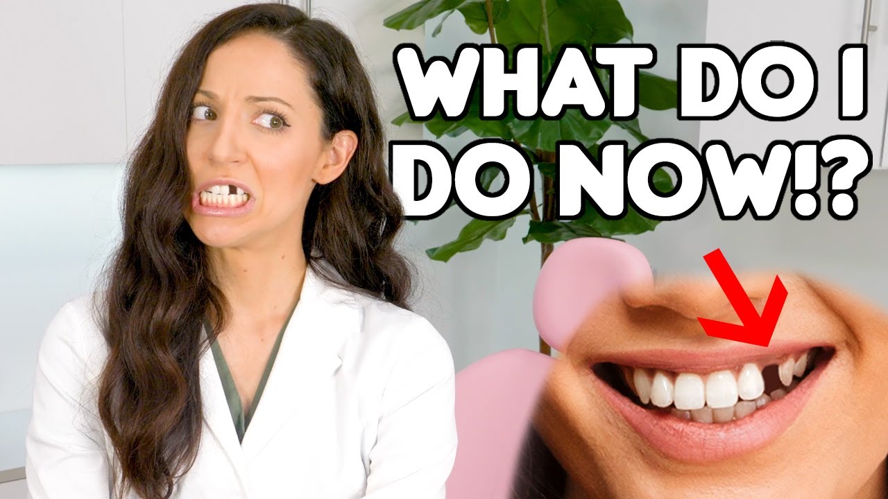 How To REPLACE A Missing Tooth (Best Tooth Replacement Options)