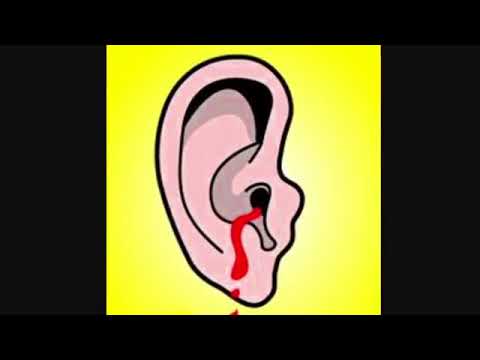 WARNING SUPER LOUD ALL HEADPHONE USERS RIP