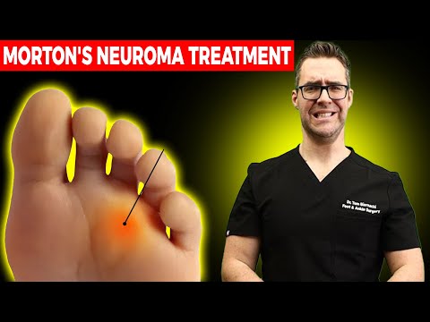 Heel Spurs Plantar Fasciitis BEST Home Treatment 2022