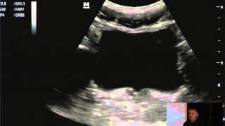 Ultrasound Podcast – Cliff Reid on EFAST