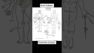 Celebrities Autopsy #kobebryant #kurtcobain #trending #shorts