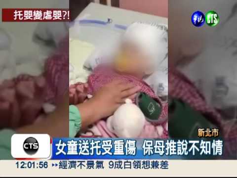 2歲女童疑遭虐 顱內出血昏迷1週