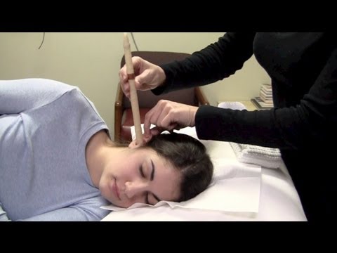Do Ear Candles Remove Earwax? Fact or Fiction... (Ear...