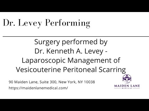 Laparoscopic Management of Vesicouterine Peritoneal Scarring