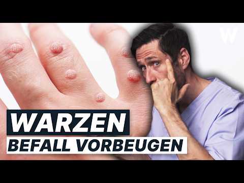 Warzen effektiv behandeln: Tipps zur Selbstbehandlung und wann ein Arztbesuch nötig ist!