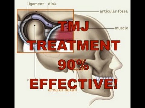 TMJ Correction / Adjustment Using Functional Cranial Release