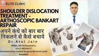 Shoulder dislocation treatment -Arthoscopic Bankart repair अपने कंधे को बार बार निकलने से कैसे बचाये