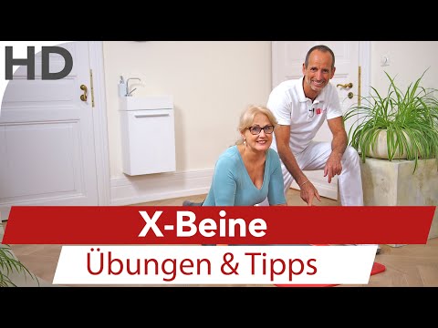 Dass man beim Ekzem auf den Händen essen kann Welche Salbe von der Schuppenflechte auf dem Kopf hilft