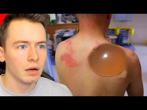 Wenn du WEGGUCKST starte das VIDEO von vorne..🤮