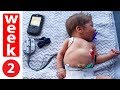 48 Hour Baby Heart Monitoring! Preston's Alarm Goes Off!!! 48 Hour Baby Heart Monitoring! Preston's Alarm Goes Off!!!